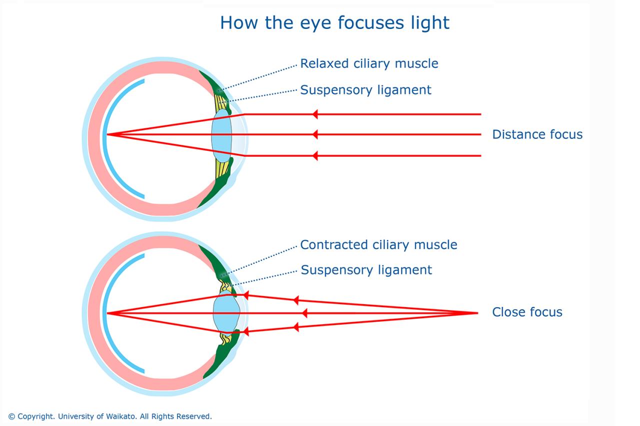 A person whose eye has a lens-to-retina distance of 2.0cm